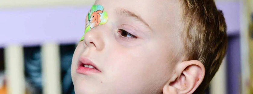 Treatments for Amblyopia